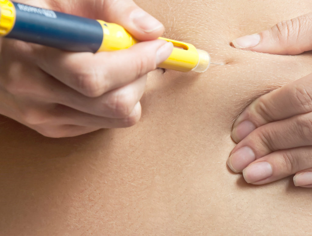 La stimulation folliculaire