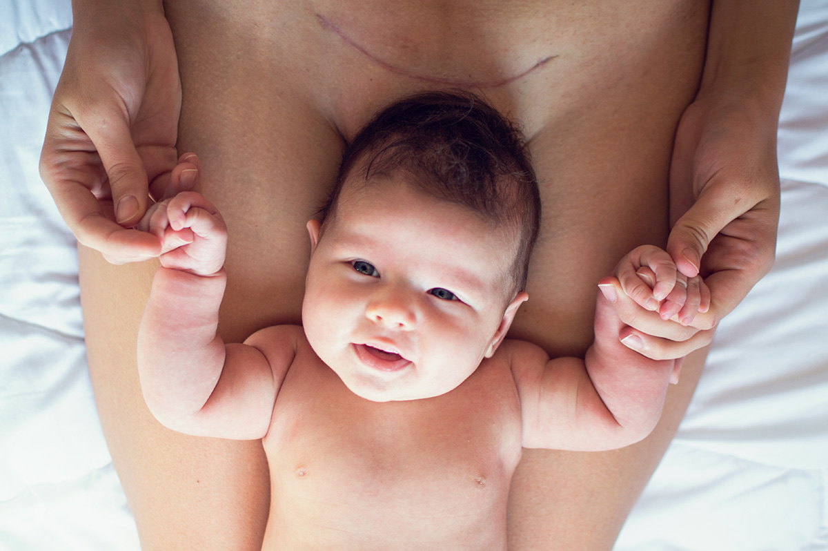 Femme césarisée avec son bébé